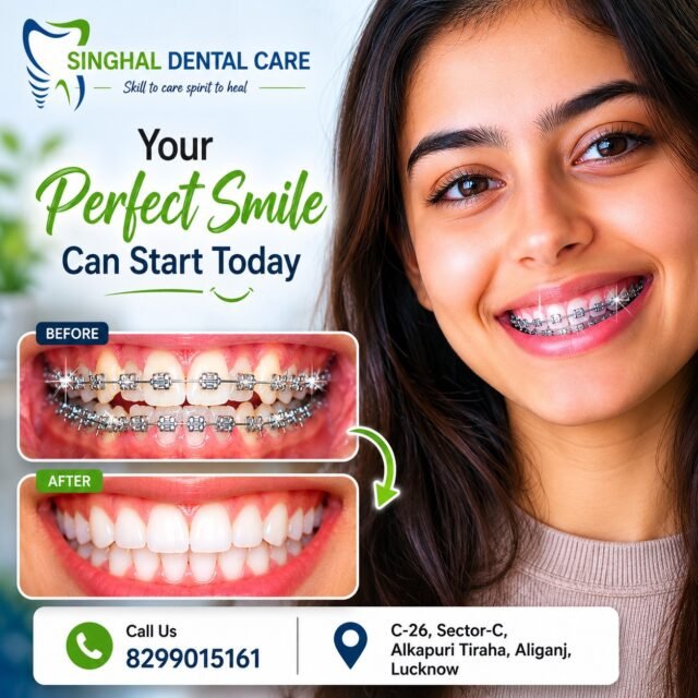 Crooked Teeth? Your Perfect Smile Starts Today! 

✨ Transform your smile with advanced braces treatment at Singhal Dental Care!
Say goodbye to crowded or uneven teeth and achieve a confident, perfectly aligned smile with expert orthodontic care.

✅ Metal Braces
✅ Smile Correction
✅ Teeth Alignment
✅ Expert Dental Consultation
✅ Personalized Treatment Plans

📍 C-26, Sector-C, Alkapuri Tiraha, Aliganj, Lucknow
📞 Call Now: 8299015161

braces treatment lucknow, orthodontist lucknow, teeth alignment, braces for crooked teeth, dental braces, smile makeover, metal braces, teeth straightening, orthodontic clinic lucknow, best dentist in lucknow, braces treatment near me, crowded teeth treatment, smile correction, dental clinic aliganj, singhal dental care

#BracesTreatment #Orthodontics #PerfectSmile #SmileMakeover #DentalCare #TeethAlignment #Braces #Orthodontist #LucknowDentist #DentalClinic #SmileTransformation #HealthySmile #MetalBraces #SinghalDentalCare #Aliganj #Lucknow #ConfidentSmile #CrookedTeeth #BeforeAfterSmile #DentalTreatment