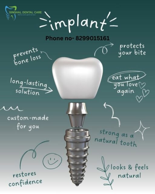 Dental Implant Treatment in Lucknow | Singhal Dental Care
Dental implants and dental bridges are advanced solutions to replace missing teeth, restore chewing function, and improve your smile's appearance. At Singhal Dental Care, we provide personalized treatment plans using high-quality materials and modern dental technology.
✅ Natural-looking results
✅ Improved chewing ability
✅ Long-lasting tooth replacement
✅ Expert dental care and consultation
📍 Singhal Dental Care, Lucknow
📞 Book Your Appointment: 082990 15161
Dental Implant Lucknow, Dental Bridge Treatment, Missing Teeth Replacement, Best Dentist in Lucknow, Tooth Implant Cost, Dental Crown and Bridge, Permanent Tooth Replacement, Implant Dentist Lucknow, Smile Restoration, Tooth Replacement Treatment, Dental Clinic Lucknow, Single Tooth Implant, Dental Prosthesis, Teeth Restoration, Oral Rehabilitation
#DentalImplant
#DentalBridge
#MissingTeeth
#SmileRestoration
#ToothReplacement
#ImplantDentist
#DentalCare
#OralHealth
#HealthySmile
#SinghalDentalCare
#LucknowDentist
#DentistLucknow
#DentalClinic
#SmileMakeover
#DentalTreatment
#BestDentistLucknow
#TeethCare
#DentalHealth
#DentalImplantsLucknow
#SmileConfidently