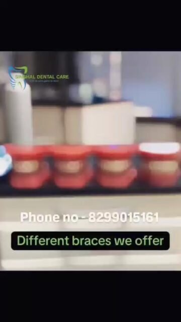 🦷 Metal Braces with Colors – Make Your Smile Stand Out! | Braces Treatment in Lucknow 
Transform your smile with colorful metal braces at Singhal Dental Care! Choose from a variety of exciting colors and make your orthodontic treatment fun while achieving perfectly aligned teeth. Our braces are effective for correcting crooked, crowded, and misaligned teeth.
✅ Colorful & Attractive Braces
✅ Correct Crooked Teeth
✅ Fix Gaps & Crowding
✅ Experienced Orthodontic Care
✅ Affordable Treatment Options
📍 Singhal Dental Care, Lucknow
📞 8299015161
metal braces, colorful braces, braces treatment lucknow, orthodontist lucknow, teeth alignment, dental braces, braces for adults, braces for teens, colorful dental braces, orthodontic treatment, crooked teeth treatment, crowded teeth braces, best dentist lucknow, smile makeover, braces clinic near me
#MetalBraces #ColorBraces #BracesTreatment #Orthodontics #SmileMakeover #DentalBraces #TeethAlignment #CrookedTeeth #BracesInLucknow #LucknowDentist #OrthodontistLucknow #SinghalDentalCare #PerfectSmile #DentalCare #SmileTransformation
