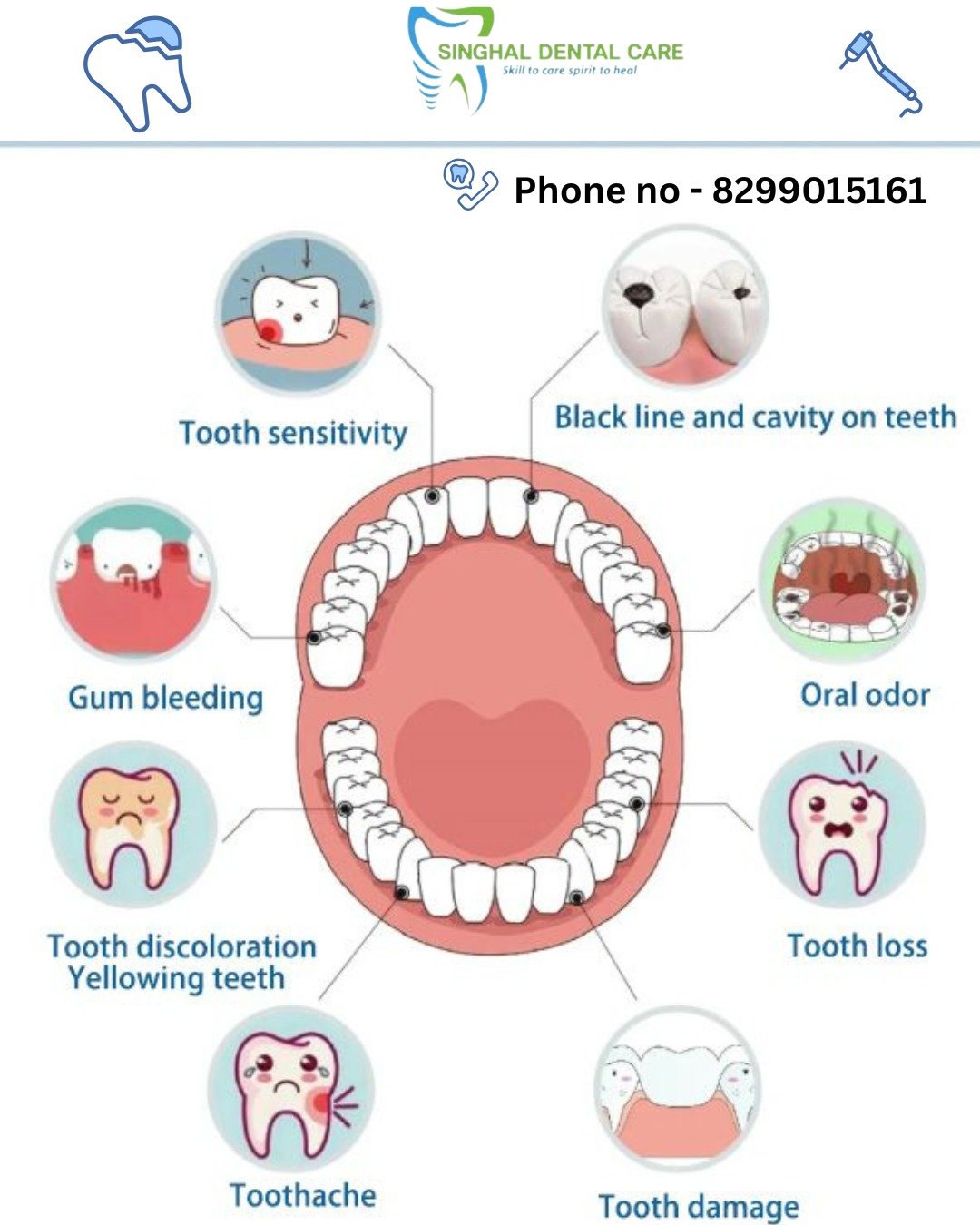 📍 Singhal Dental Care, Aliganj, Lucknow
📞 8299015161

Brushing Tips
Oral Hygiene Tips
Dental Care Tips
Tooth Brushing Duration
Healthy Teeth Tips
Dentist Advice Lucknow
Proper Brushing Technique
Dental Health Awareness
Singhal Dental Care
Teeth Cleaning Tips
Oral Care Routine
Prevent Tooth Damage
Best Dental Clinic Lucknow
Daily Dental Care
Brushing Habits

#DentalTips #BrushingTips #OralHealth #DentalCare #HealthyTeeth #ToothBrushing #SmileCare #DentalAwareness #OralHygiene #SinghalDentalCare #LucknowDentist #HealthySmile #TeethCare #DentistAdvice #DailyDentalTips #DentalClinic #PreventToothDamage #SmileHealthy #DentalHealth #BrushSmart