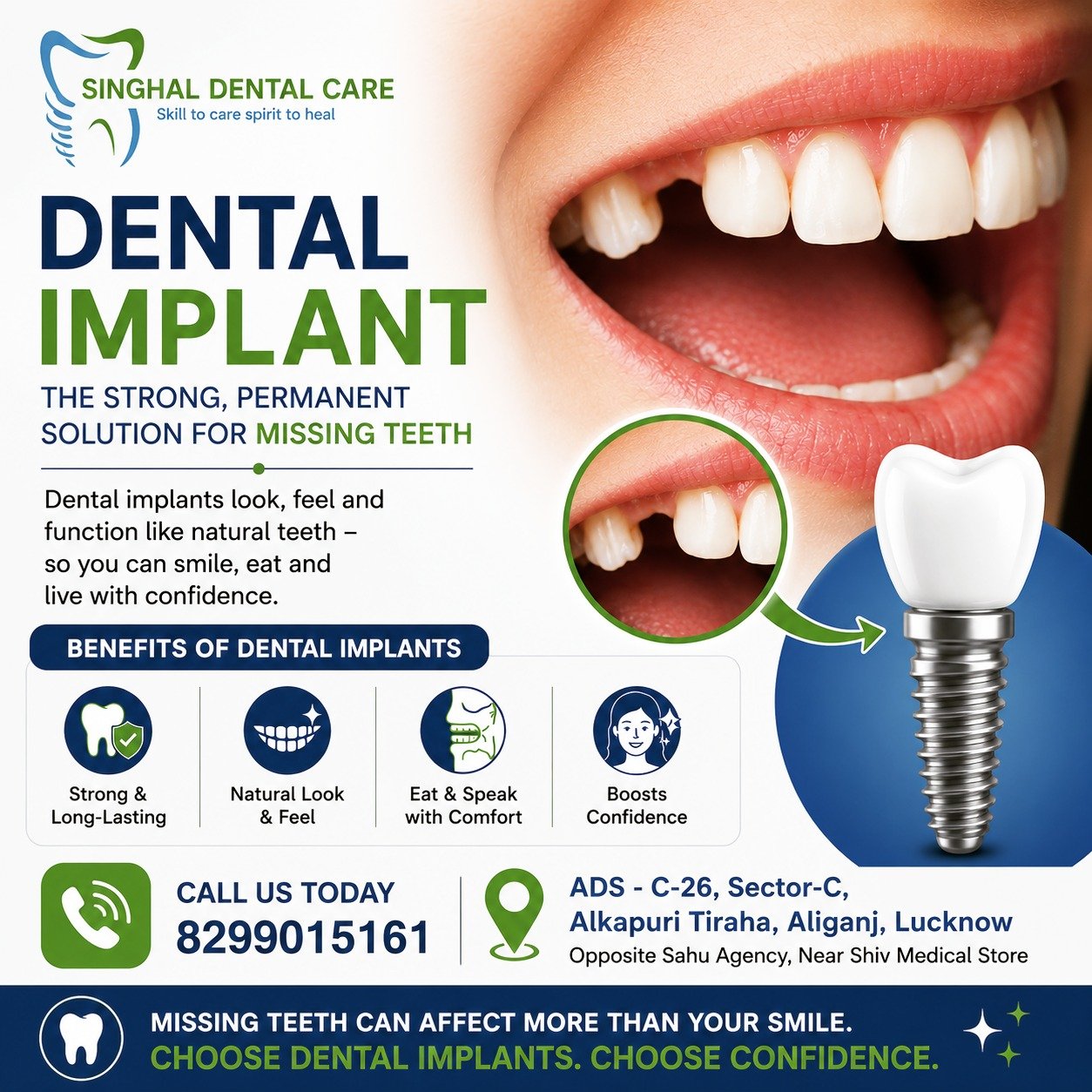 Dental Implant Treatment – Strong Teeth, Confident Smile
 
Missing a tooth? Dental implants are a long-lasting and natural-looking solution to restore your smile, confidence, and chewing ability.

✅ Permanent replacement for missing teeth
✅ Natural appearance and comfort
✅ Improved chewing and speech
✅ Strong, durable, and reliable solution
✅ Advanced implant technology

📍 Singhal Dental Care
C-26, Sector-C, Alkapuri Tiraha, Aliganj, Lucknow
Opposite Sahu Agency, Near Shiv Medical Store

📞 Call Now: 8299015161

dental implant treatment lucknow, dental implants lucknow, best implant dentist lucknow, tooth replacement lucknow, missing teeth treatment, dental implant clinic aliganj, singhal dental care, implant specialist lucknow, permanent teeth replacement, affordable dental implants lucknow, dental clinic aliganj, smile makeover lucknow, implant surgery lucknow, tooth implant cost lucknow,

#DentalImplant, #DentalImplantsLucknow, #ImplantTreatment, #MissingTeeth, #SmileMakeover, #SinghalDentalCare, #DentalClinicLucknow, #BestDentistLucknow, #ToothReplacement, #OralHealth, #DentalCare, #SmileConfidence, #ImplantDentist, #AliganjLucknow, #LucknowDentist, #DentalTreatment, #HealthySmile, #PermanentTeeth, #DentalHealth, #Lucknow