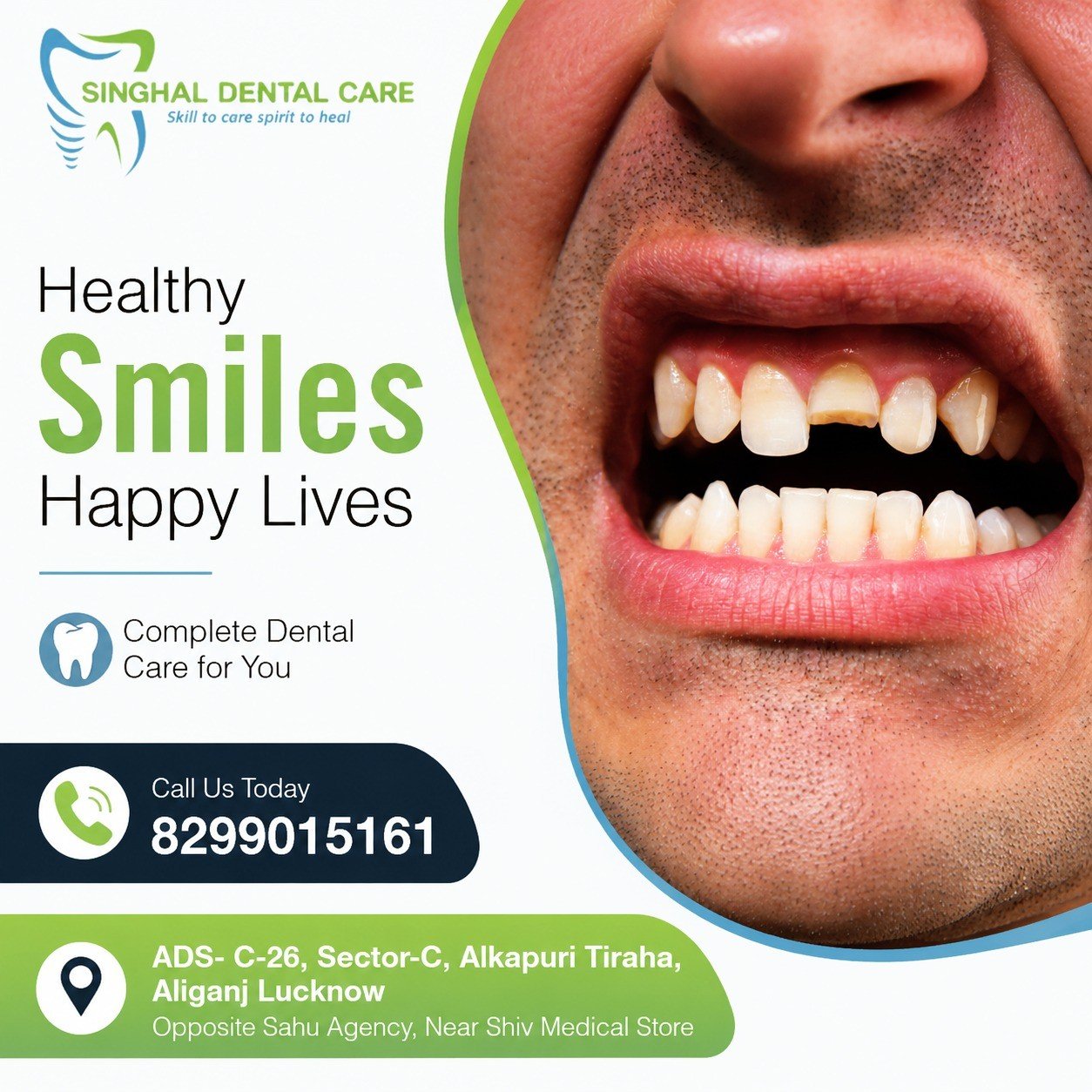 🦷 Broken Tooth? Restore Your Smile with Expert Dental Care in Lucknow | Singhal Dental Care

A broken or chipped tooth can affect your smile, confidence, and oral health. At Singhal Dental Care, Lucknow, we provide advanced dental treatments including tooth-colored fillings, crowns, veneers, root canal treatment, and dental implants. Our experienced dental team helps restore your smile with personalized care and modern technology.

📍 C-26, Sector-C, Alkapuri Tiraha, Aliganj, Lucknow
📞 8299015161

broken tooth treatment Lucknow, chipped tooth repair, dentist in Aliganj Lucknow, dental clinic Lucknow, tooth restoration, cosmetic dentistry Lucknow, dental crown treatment, tooth filling treatment, smile makeover Lucknow, dental implant Lucknow, emergency dentist Lucknow, Singhal Dental Care, best dentist near me, dental veneer treatment, front tooth repair

#SinghalDentalCare #BrokenTooth #ChippedTooth #DentalCareLucknow #DentistLucknow #SmileRestoration #dentalimplants #rootcanaltreatment #cosmeticdentistry #HealthySmile #DentalClinicLucknow #ToothRepair #AliganjLucknow #smilemakeover #DentalTreatment #OralHealth #LucknowDentist #BestDentistLucknow #DentalCare #DentalHealth