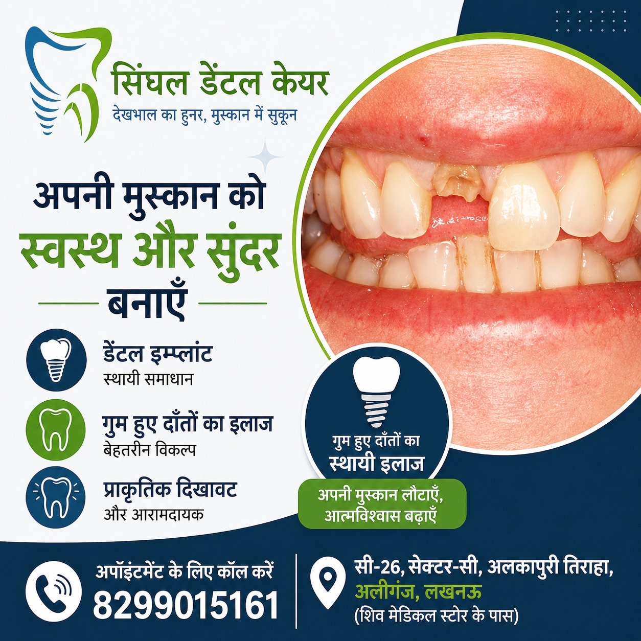 🦷 क्या आपके दाँत में खाली जगह है? मुस्कान वापस पाएं डेंटल इम्प्लांट से!

क्या आपके एक या अधिक दाँत टूट गए हैं या निकल गए हैं? अब चिंता की जरूरत नहीं। Singhal Dental Care, Aliganj Lucknow में आधुनिक डेंटल इम्प्लांट उपचार उपलब्ध है, जो प्राकृतिक दाँत जैसा लुक और आराम प्रदान करता है। अनुभवी डॉक्टरों द्वारा सुरक्षित और विश्वसनीय उपचार।

📍 C-26, Sector-C, Alkapuri Tiraha, Aliganj, Lucknow (Near Shiv Medical Store)
📞 8299015161

Dental Implant Lucknow, Missing Teeth Treatment Lucknow, Best Dentist Aliganj, Dental Implant Clinic Lucknow, Tooth Replacement Lucknow, Implant Dentist Lucknow, Singhal Dental Care, Dental Clinic Aliganj, Missing Tooth Solution, Teeth Replacement Cost Lucknow, Permanent Teeth Solution, Dental Implant Near Me, Dentist Near Shiv Medical Store, Smile Restoration Lucknow, Best Dental Clinic Lucknow

#DentalImplantLucknow
#SinghalDentalCare
#MissingTeethSolution
#SmileMakeover
#DentalClinicLucknow
#BestDentistLucknow
#AliganjDentist
#ToothReplacement
#HealthySmile
#ImplantTreatment
#LucknowDentalCare
#PermanentTeethSolution
#SmileConfidence
#DentistNearMe
#lucknowblogger