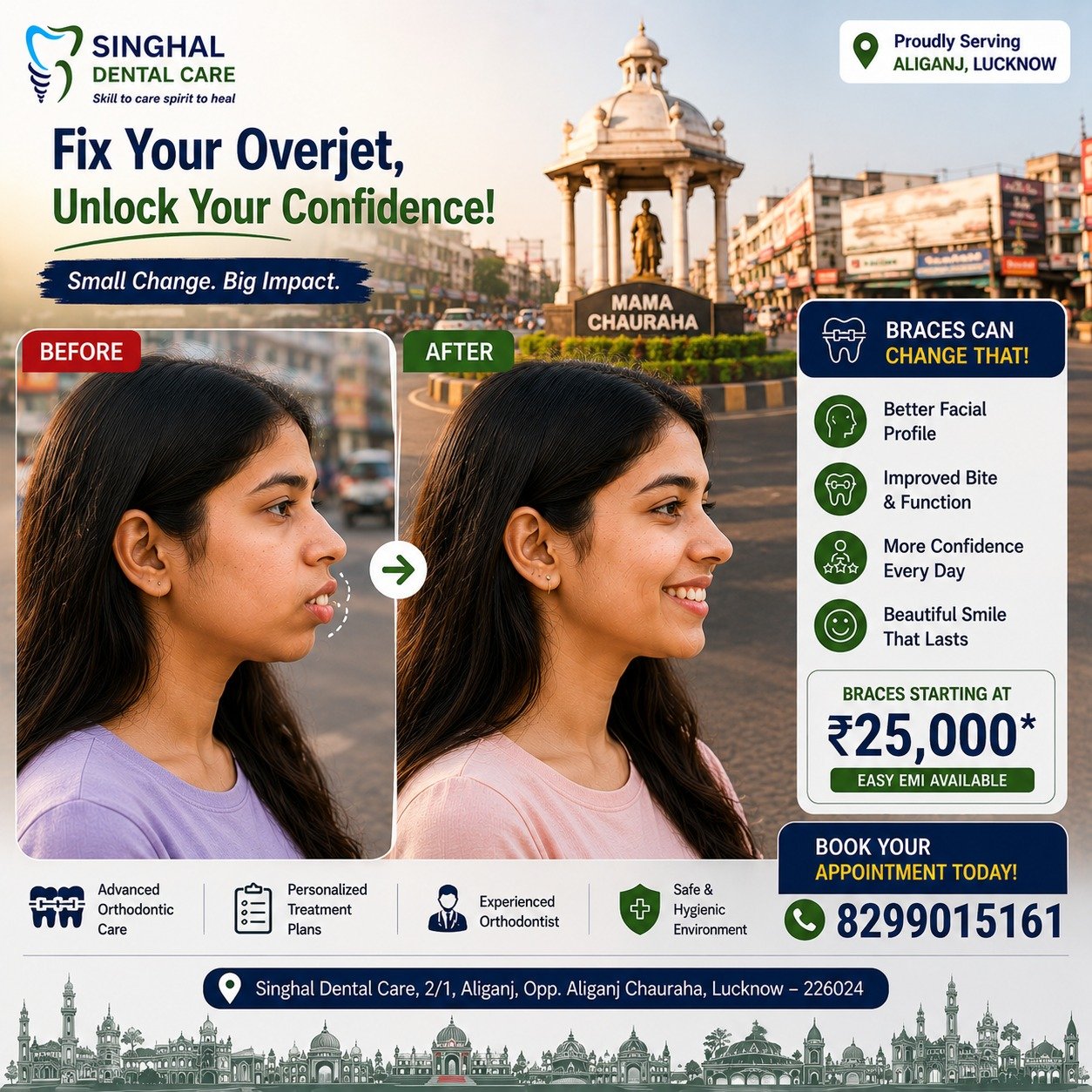 Fix Protruding Front Teeth with Braces | Orthodontic Treatment in Lucknow

Do your front teeth stick out more than normal?

A small change in tooth alignment can make a noticeable difference to your smile, bite, and confidence.

Discover how braces can help improve proclined teeth (increased overjet) with a personalized orthodontic treatment plan.

Why choose Singhal Dental Care?

✅ 15+ Years of Trusted Dental Care

✅ 25,000+ Happy Patients

✅ Experienced Orthodontic Team

✅ Personalized Braces Treatment Plans

✅ Easy EMI Options Available

✅ Open 7 Days a Week

📍 Singhal Dental Care
C-26, Sector C, Alkapuri Tiraha, Aliganj, Lucknow
Opp. Sahu Electronics

📞 Call / WhatsApp: 8299015161 

Braces Treatment Lucknow
Overjet Treatment Lucknow
Proclined Teeth Treatment
Orthodontist Lucknow
Teeth Alignment Lucknow
Front Teeth Correction
Smile Correction
Dental Braces
Orthodontic Clinic
Braces for Overjet

Braces Treatment Aliganj
Dentist Aliganj Lucknow
Orthodontist Aliganj
Dental Clinic Lucknow
Braces Near Mama Chauraha
Dentist Near Aliganj Chauraha
Orthodontic Treatment Lucknow
Teeth Alignment Aliganj

#Braces #Orthodontics #DentalCare #HealthySmile #SmileTransformation#Overjet #ProclinedTeeth #TeethAlignment #BracesTreatment #SmileCorrection #OrthodonticCare#LucknowDentist #Lucknow #Aliganj #DentalClinicLucknow #OrthodontistLucknow#SinghalDentalCare #25KHappyPatients #TrustedDentalCare #SmileWithConfidence #BracesLucknow