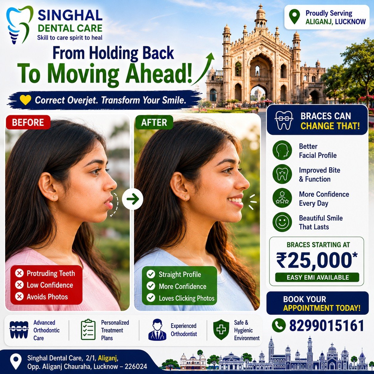 Correct Protruding Front Teeth with Braces in Aliganj, Lucknow | Singhal Dental Care

A small correction can completely transform your smile.

If your upper front teeth are too far forward (Increased Overjet / Proclination), braces can safely correct their position while improving both function and appearance.

✨ Better Profile
✨ Better Smile
✨ Better Bite
✨ Better Confidence

Your smile journey starts with a consultation.

📍 Aliganj, Lucknow

☎️ 8299015161

Braces Treatment Lucknow
Braces Aliganj
Orthodontist Lucknow
Braces for Overjet
Protruding Teeth Treatment
Increased Overjet Treatment
Proclined Teeth Correction
Teeth Alignment Lucknow

Braces Clinic Aliganj
Orthodontist Aliganj
Braces Near Aliganj Chauraha
Teeth Alignment Lucknow
Dental Clinic Aliganj Lucknow
Best Braces Doctor Lucknow
Orthodontic Clinic Near Me
Smile Correction Aliganj

#LucknowDentist #LucknowBraces #Aliganj #AliganjLucknow #LucknowDentalClinic #SinghalDentalCare #LucknowOrthodontist #BracesLucknow#BracesTreatment #Orthodontics #SmileTransformation #HealthySmile #BeforeAndAfter #DentalCare #SmileJourney #TeethAlignment #Confidence #Orthodontist#SinghalDentalCare #SkillToCareSpiritToHeal #SmileWithConfidence #SinghalSmiles #TrustedDentistLucknow