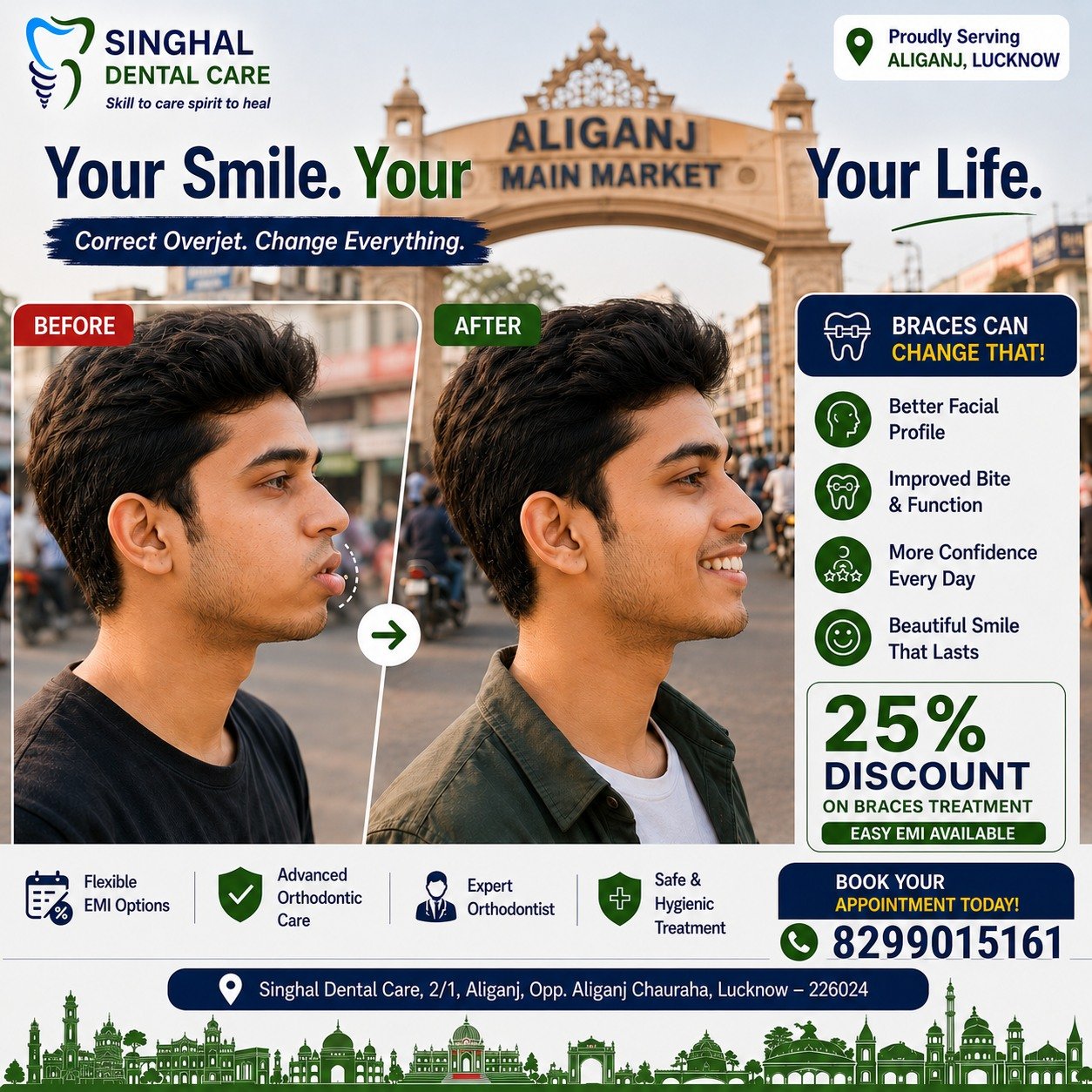 Fix Protruding Front Teeth with Braces | Orthodontist in Aliganj, Lucknow
Why choose Singhal Dental Care?

✅ 15+ Years of Trusted Dental Care

✅ 25,000+ Happy Patients

✅ Experienced Orthodontic Team

✅ Personalized Treatment Plans

✅ Easy EMI Options Available

✅ Open 7 Days a Week

📍 Singhal Dental Care
C-26, Sector C, Alkapuri Tiraha, Aliganj, Lucknow
Opp. Sahu Electronics

📞 Call / WhatsApp: 8299015161

🌐 Website: https://singhaldentalcare.com

Braces for Increased Overjet
Proclined Teeth Treatment
Braces Treatment Lucknow
Orthodontist Lucknow
Teeth Alignment Treatment
Braces for Forward Teeth
Braces Clinic Aliganj
Dental Braces Lucknow

Best Orthodontist in Aliganj
Braces Treatment in Aliganj Lucknow
Teeth Alignment Clinic Lucknow
Orthodontic Clinic Near Aliganj
Dental Braces Near Kapoorthala
Braces Near Engineering College Chauraha
Smile Correction Lucknow
Teeth Straightening Aliganj

Braces Clinic Near Me
Orthodontist Near Me
Teeth Alignment Near Me
Dental Braces Near Me
Smile Correction Near Me
Best Dentist Near Me for Braces

#BracesLucknow #OverjetCorrection #ProclinedTeeth #OrthodontistLucknow #BracesTreatment #SmileCorrection #TeethAlignment #DentalBraces #SmileTransformation #BeforeAfterBraces #SinghalDentalCare #AliganjLucknow #HealthySmile #ConfidenceStartsWithASmile #Orthodontics