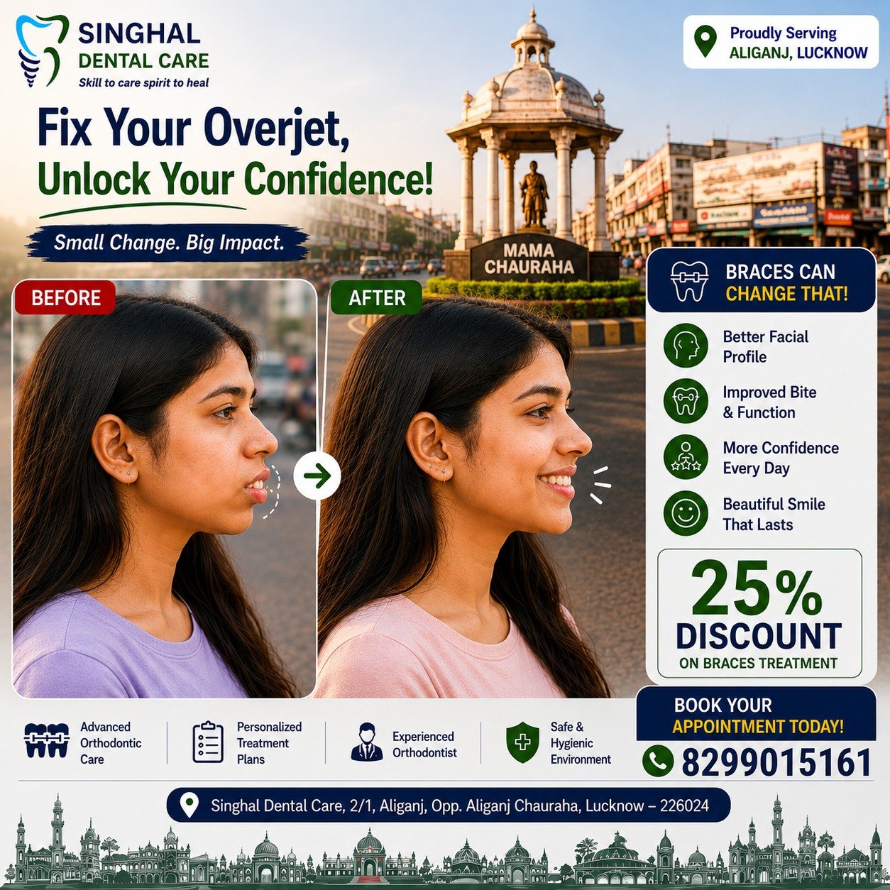 Correct Protruding Front Teeth with Braces in Aliganj, Lucknow | Singhal Dental Care

Do your front teeth stick out more than they should?

An increased overjet (protruding front teeth) is more than a cosmetic concern. It can affect your facial profile, confidence, speech, bite, and increase the risk of dental injuries.

With customized braces treatment, your teeth are gradually moved into their ideal position, creating a healthier bite and a more balanced facial appearance.

✅ Better Smile
✅ Improved Facial Profile
✅ Better Bite Function
✅ More Confidence

📍Singhal Dental Care, Aliganj, Lucknow

📞 8299015161

Braces Treatment Lucknow
Braces Aliganj
Orthodontist Lucknow
Braces for Overjet
Protruding Teeth Treatment
Increased Overjet Treatment
Proclined Teeth Correction
Teeth Alignment Lucknow

Braces Clinic Aliganj
Orthodontist Aliganj
Braces Near Aliganj Chauraha
Teeth Alignment Lucknow
Dental Clinic Aliganj Lucknow
Best Braces Doctor Lucknow
Orthodontic Clinic Near Me
Smile Correction Aliganj

Braces Near Me
Orthodontist Near Me
Teeth Alignment Near Me
Dental Clinic Near Me
Smile Correction Near Me
Braces Clinic Aliganj Near Me

#BracesTreatment #Orthodontics #SmileTransformation #HealthySmile #BeforeAndAfter #DentalCare #SmileJourney #TeethAlignment #Confidence #Orthodontist#SinghalDentalCare #SkillToCareSpiritToHeal #SmileWithConfidence #SinghalSmiles #TrustedDentistLucknow#SinghalDentalCare #SkillToCareSpiritToHeal #SmileWithConfidence #SinghalSmiles #TrustedDentistLucknow