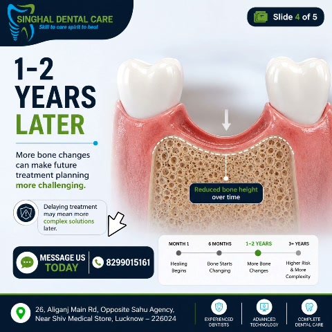 Braces for Spacing Between Teeth in Lucknow | Orthodontic Treatment | Singhal Dental 
Care

🦷 Gap between your teeth? The answers you're looking for may be simpler than you think.

Gap Between Your Teeth? Ask Us About Braces.

Braces can help close unwanted spaces between teeth while improving smile appearance and bite alignment.

✔ Personalized Treatment Plan

✔ Digital Diagnosis

✔ Experienced Orthodontic Team

✔ EMI Available

📍 Singhal Dental Care
26, Aliganj Main Road, Opposite Sahu Agency, Near Shiv Medical Store, Lucknow – 226024

📞 Call / WhatsApp: 8299015161

🌐 www.singhaldentalcare.com

Braces Lucknow
Spacing Between Teeth
Gap Teeth Treatment
Orthodontist Lucknow
Teeth Gap Braces
Teeth Alignment
Dental Braces
Orthodontic Treatment
Smile Correction
Braces Consultation

Braces Aliganj
Orthodontist Lucknow
Braces Clinic Lucknow
Teeth Gap Treatment Aliganj
Best Dentist Lucknow
Dental Clinic Aliganj
Orthodontic Consultation Lucknow
Singhal Dental Care Lucknow

#Braces #Orthodontics #SpacingBetweenTeeth #GapTeeth #TeethAlignment #SmileCorrection #DentalBraces#BracesLucknow #OrthodontistLucknow #AliganjLucknow #DentalClinicLucknow #LucknowDentist#SinghalDentalCare #SmileTransformation #HealthySmile #BracesJourney #ConfidentSmile #DentalCare