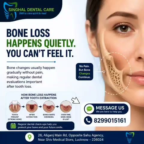 Bone Loss After Tooth Loss | Dental Implant Awareness | Lucknow

🦷 Bone loss doesn't usually hurt.

That doesn't mean nothing is happening beneath your gums.

Why many patients choose dental implants

✅ Replace the missing tooth root

✅ Restore comfortable chewing

✅ Natural-looking smile

✅ Help support long-term oral function

📍 Singhal Dental Care

26, Aliganj Main Road,

Opposite Sahu Agency,

Near Shiv Medical Store,

Lucknow – 226024

📞 Call / WhatsApp: 8299015161

Bone Loss After Tooth Loss
Bone Loss After Tooth Extraction
Dental Implant Lucknow
Missing Teeth Treatment
Tooth Replacement Lucknow
Jawbone Loss
Dental Implant Clinic
Implant Dentist Lucknow
Bone Preservation Dentistry
Tooth Loss Treatment

Dental Implant Aliganj
Implant Dentist Lucknow
Tooth Replacement Lucknow
Missing Teeth Treatment Lucknow
Dental Clinic Aliganj
Bone Loss Treatment Lucknow
Best Dentist Aliganj
Singhal Dental Care Lucknow

#DentalImplants #MissingTeeth #BoneLoss #ToothExtraction #ToothReplacement #JawboneHealth #SmileRestoration#DentalImplantsLucknow #LucknowDentist #AliganjLucknow #DentalClinicLucknow #ImplantDentistLucknow#SinghalDentalCare #ImplantJourney #DentalAwareness #HealthySmile #TrustedDentalCare #SmileWithConfidence