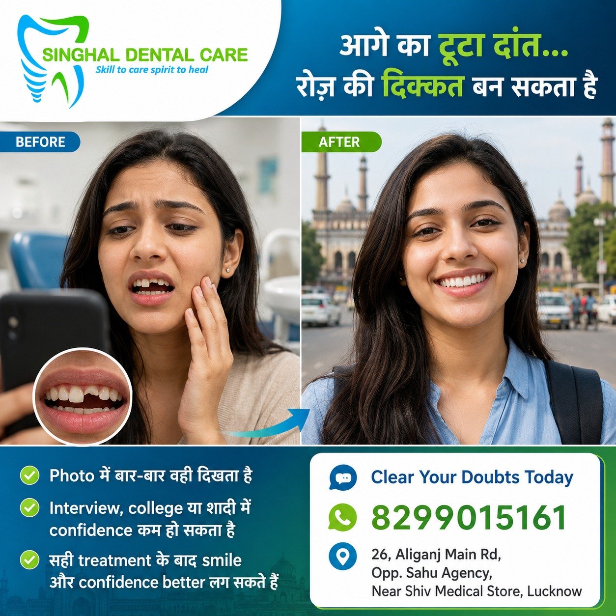 टूटा Front Tooth? Smile और Confidence वापस पाएं

आगे का टूटा या chipped tooth आपकी photos, interview, college और शादी के confidence को प्रभावित कर सकता है। Natural-looking front tooth restoration और smile correction के लिए Singhal Dental Care, Aliganj, Lucknow में consultation book करें।

आगे का टूटा दांत सिर्फ smile नहीं, रोज़ का confidence भी प्रभावित कर सकता है।

📸 Photos में वही टूटा दांत बार-बार दिखाई देना
🎓 Interview या college में बोलते समय hesitation
💍 शादी और functions में खुलकर smile न कर पाना
😊 अपनी appearance को लेकर conscious रहना

दांत की condition और fracture की severity देखकर suitable treatment plan बनाया जाता है। कई suitable cases में tooth-coloured restoration से natural shape और appearance वापस पाने में मदद मिल सकती है।

📍 Singhal Dental Care, Aliganj, Lucknow
📞 Call/WhatsApp: 8299015161

Broken front tooth treatment Lucknow, chipped tooth repair Lucknow, front tooth restoration, fractured tooth treatment, cosmetic dentist Lucknow, dental bonding Lucknow, natural-looking tooth repair, smile correction Aliganj, tooth-coloured restoration, broken tooth dentist near me, smile restoration Lucknow, Singhal Dental Care.

#BrokenTooth #ChippedTooth #FrontToothRepair #ToothRestoration #DentalBonding #CosmeticDentistry #SmileCorrection #SmileRestoration #ConfidentSmile #LucknowDentist #AliganjLucknow #DentalClinicLucknow #SinghalDentalCare