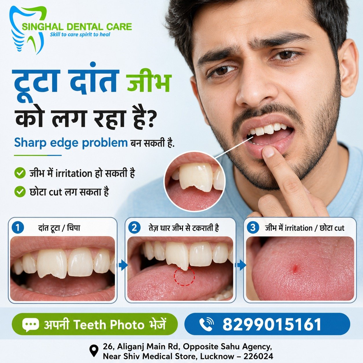 टूटा दांत जीभ को चुभ रहा है? इसे Ignore न करें

Chipped या broken front tooth की sharp edge जीभ से बार-बार टकराकर irritation या छोटा cut कर सकती है। Rough tooth edge treatment, chipped tooth repair और natural-looking restoration के लिए Singhal Dental Care, Aliganj, Lucknow में consultation करें।

✅ Sharp edge जीभ से टकरा सकती है
✅ छोटा cut या soreness हो सकती है
✅ खाना और बोलना uncomfortable लग सकता है
✅ Early repair से edge smooth की जा सकती है
✅ Tooth की natural shape restore की जा सकती है

📍 Singhal Dental Care, Aliganj, Lucknow
📞 8299015161

chipped tooth repair Lucknow, sharp tooth edge treatment, rough tooth edge treatment, tongue irritation from broken tooth, tongue cut from chipped tooth, broken front tooth treatment, fractured tooth repair Lucknow, dental bonding Lucknow, tooth-coloured restoration, cosmetic dentist Aliganj, front tooth restoration, Singhal Dental Care.

#ChippedTooth #BrokenTooth #SharpToothEdge #TongueIrritation #TongueCut #FrontToothRepair #DentalBonding #ToothRestoration #LucknowDentist #AliganjLucknow #SinghalDentalCare