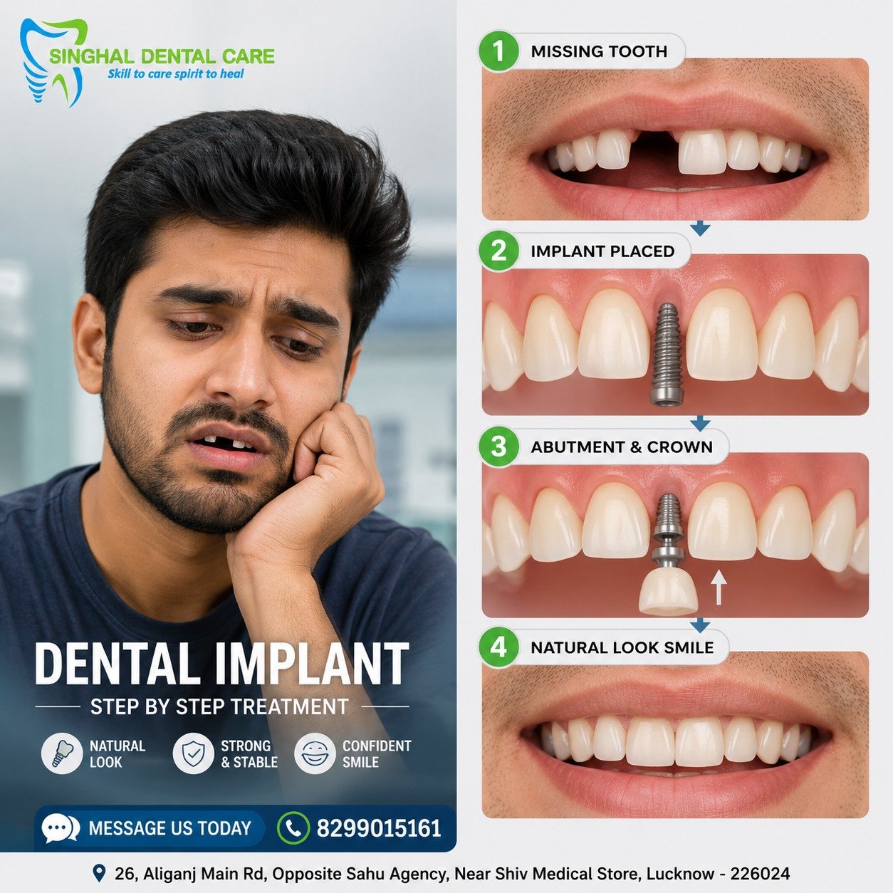 Missing Tooth? Dental Implant से Natural Smile वापस पाएं

Missing front tooth के लिए dental implant treatment में implant placement, abutment और crown की step-by-step planning की जाती है। Natural-looking tooth replacement और implant consultation के लिए Singhal Dental Care, Aliganj, Lucknow से संपर्क करें।

📍 Singhal Dental Care, Aliganj, Lucknow
📞 Call/WhatsApp: 8299015161

dental implant Lucknow, single tooth implant Lucknow, missing front tooth treatment, fixed tooth replacement Lucknow, dental implant step by step, implant crown treatment, tooth implant Aliganj, missing tooth replacement, natural-looking dental implant, implant dentist Lucknow, dental implant consultation, 
Singhal Dental Care

#DentalImplants #SingleToothImplant #MissingTooth #ToothReplacement #DentalImplantsLucknow #ImplantDentistLucknow #FixedTeeth #NaturalSmile #ImplantConsultation #AliganjLucknow #LucknowDentist #SinghalDentalCare