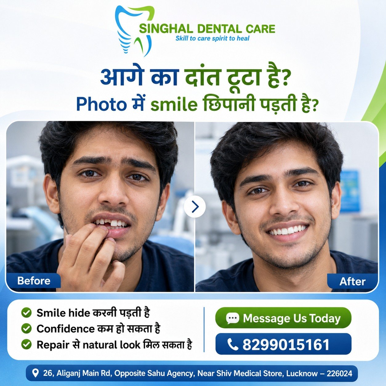 टूटा Front Tooth? फिर से खुलकर Smile करें

Broken या chipped front tooth आपकी photos और confidence को प्रभावित कर सकता है। Natural-looking front tooth repair, dental bonding और smile restoration के लिए Singhal Dental Care, Aliganj, Lucknow में consultation book करें।

✅ Smile hide करने की जरूरत कम हो सकती है
✅ Natural shape और colour matching
✅ Confidence बेहतर हो सकता है
✅ Personalized front tooth treatment
✅ Early consultation से सही option समझ आता है

📍 Singhal Dental Care, Aliganj, Lucknow
📞 8299015161

broken front tooth treatment Lucknow, chipped tooth repair Lucknow, front tooth restoration, natural-looking tooth repair, dental bonding Lucknow, smile restoration Lucknow, cosmetic dentist Aliganj, tooth-coloured restoration, fractured tooth treatment, broken tooth dentist near me, front tooth repair Aliganj, Singhal Dental Care.

#BrokenTooth #ChippedTooth #FrontToothRepair #SmileRestoration #DentalBonding #NaturalSmile #CosmeticDentistry #ConfidentSmile #LucknowDentist #AliganjLucknow #SinghalDentalCare
