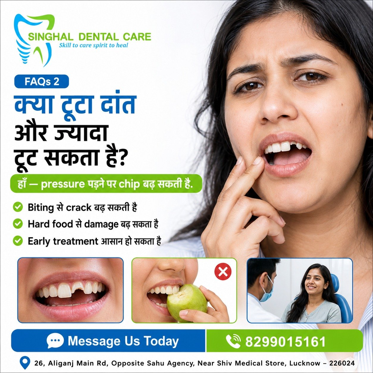 क्या टूटा दांत और ज्यादा टूट सकता है?

Chipped या broken front tooth पर biting pressure पड़ने से crack और damage बढ़ सकता है। Hard food से बचें और early dental evaluation कराएँ। Chipped tooth repair और front tooth restoration के लिए Singhal Dental Care, Aliganj, Lucknow से संपर्क करें।

chipped tooth treatment Lucknow, broken front tooth repair, cracked tooth treatment Lucknow, minor tooth fracture, chipped tooth getting worse, hard food tooth damage, front tooth restoration, dental bonding Lucknow, tooth-coloured restoration, cosmetic dentist Aliganj, broken tooth dentist near me, Singhal Dental Care

#ChippedTooth #BrokenTooth #CrackedTooth #FrontToothRepair #DentalBonding #ToothRestoration #DentalAwareness #LucknowDentist #AliganjLucknow #SinghalDentalCare