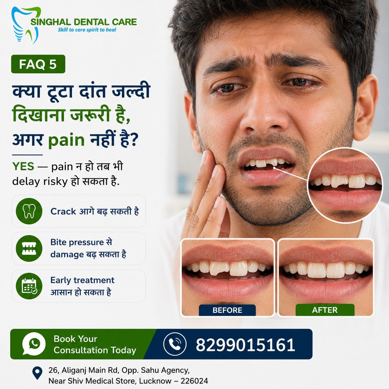 टूटा दांत Pain नहीं कर रहा? फिर भी Delay न करें

Chipped या broken front tooth में pain न होने पर भी crack आगे बढ़ सकती है और biting pressure से damage बढ़ सकता है। Early dental check-up से tooth की condition समझकर suitable और comparatively simple repair plan किया जा सकता है। Singhal Dental Care, Aliganj, Lucknow में consultation book करें।

दांत टूट गया है, लेकिन pain नहीं है—क्या फिर भी dentist को दिखाना जरूरी है?

हाँ। Pain न होने का मतलब यह नहीं कि tooth पूरी तरह safe है।

✅ Crack धीरे-धीरे आगे बढ़ सकती है
✅ Bite pressure से chip बड़ा हो सकता है
✅ अंदरूनी tooth damage छिपा हो सकता है
✅ Sharp edge होंठ या जीभ को irritate कर सकती है
✅ Early treatment आसान हो सकता है

📍 Singhal Dental Care, Aliganj, Lucknow
📞 8299015161

broken tooth treatment Lucknow, chipped tooth without pain, cracked tooth treatment Aliganj, broken front tooth repair, chipped front tooth dentist Lucknow, dental bonding Lucknow, tooth crack evaluation, painless broken tooth treatment, cosmetic tooth repair Aliganj, front tooth restoration Lucknow, emergency dentist Aliganj, Singhal Dental Care

#BrokenTooth #ChippedTooth #CrackedTooth #FrontToothRepair #DentalBonding #EarlyTreatment #DentalCheckup #LucknowDentist #AliganjLucknow #SinghalDentalCare