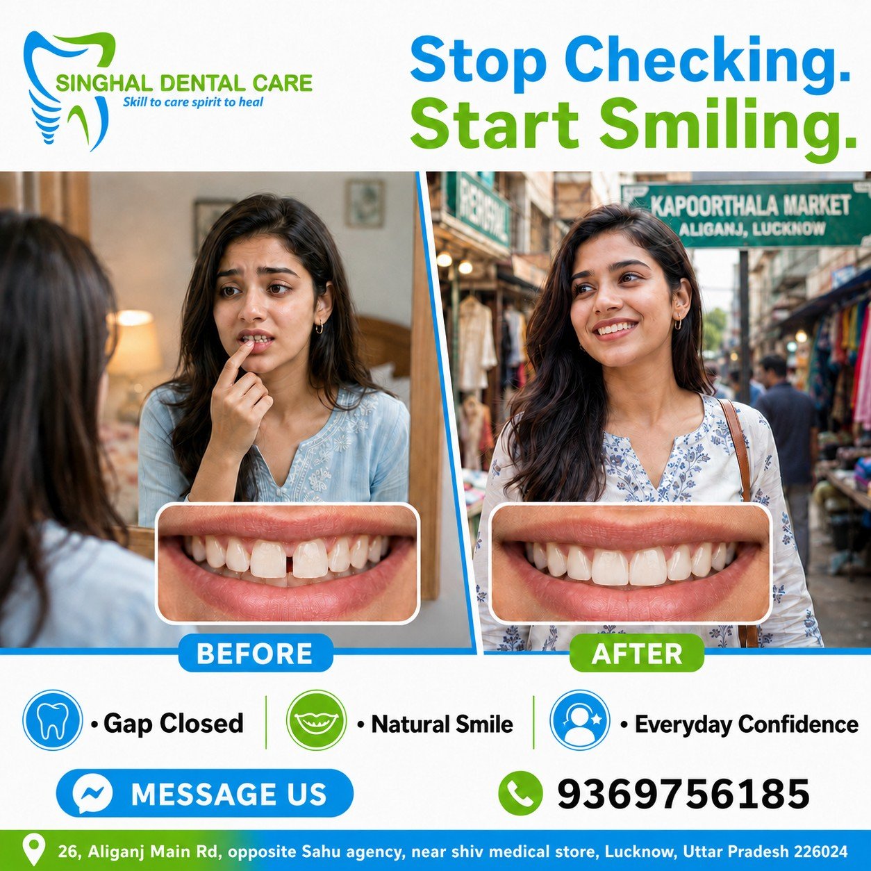 Teeth Gap को बार-बार Check करना बंद करें—Confident Smile शुरू करें

Front teeth के बीच छोटा gap भी mirror, photos और social situations में बार-बार notice हो सकता है। Teeth gap closure, braces, clear aligners या suitable cosmetic treatment से smile अधिक natural और confident दिख सकती है। Singhal Dental Care, Aliganj, Lucknow में smile consultation book करें।

क्या आप बार-बार mirror में अपना teeth gap check करते हैं?

Front teeth का छोटा gap भी smile करते समय self-conscious feel करा सकता है।

✅ Front teeth gap closure options
✅ Natural-looking smile planning
✅ Braces या clear aligners की suitability check
✅ Selected cases में cosmetic treatment option
✅ Everyday confidence बेहतर हो सकता है

📍 Singhal Dental Care, Aliganj, Lucknow
📞 9369756185

teeth gap treatment Lucknow, front teeth gap closure, dental spacing treatment, braces for teeth gap Lucknow, clear aligners Aliganj, diastema treatment Lucknow, cosmetic gap closure, smile correction Lucknow, orthodontic treatment Aliganj, confident smile treatment, dentist near Kapoorthala Market, Singhal Dental Care

#TeethGap #GapClosure #FrontTeethSpacing #BracesTreatment #ClearAligners #DiastemaTreatment #SmileConfidence #Kapoorthala #AliganjLucknow #LucknowDentist #SinghalDentalCare
