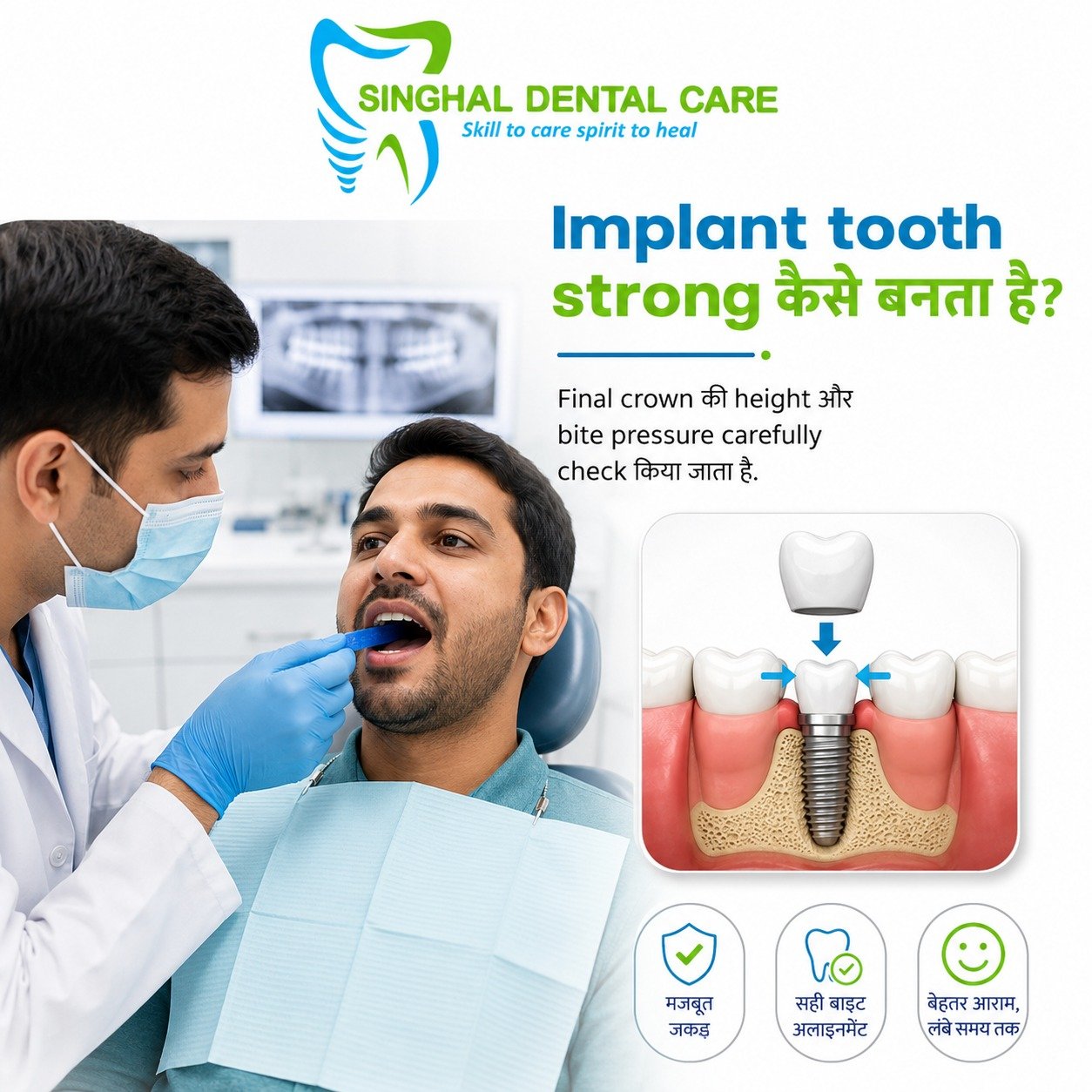 Dental Implant Tooth Strong कैसे बनता है?

Dental implant की long-term stability केवल implant screw पर नहीं, बल्कि सही crown height, bite pressure और crown fitting पर भी depend करती है। Final crown लगाने से पहले bite alignment carefully check किया जाता है, ताकि chewing comfortable रहे और implant पर unnecessary pressure न पड़े।

Dental implant tooth को strong और comfortable बनाने में सही bite planning बहुत महत्वपूर्ण होती है।

Final crown लगाते समय उसकी height और आसपास के दांतों के साथ alignment carefully check किया जाता है।

✅ Crown height evaluate की जाती है
✅ Bite pressure balance किया जाता है
✅ Crown fitting check होती है
✅ Chewing comfort assess किया जाता है
✅ Follow-up में implant और bite monitor किए जाते हैं

📍 Singhal Dental Care, C-26, Sector-C, Alkapuri Tiraha, Aliganj, Lucknow
📞 8299015161

dental implant bite adjustment, implant crown fitting Lucknow, dental implant crown height, bite pressure check after implant, strong dental implant tooth, implant occlusion adjustment, final crown after dental implant, implant crown planning Aliganj, dental implant stability, implant chewing comfort, implant dentist Lucknow, Singhal Dental Care

#DentalImplant #ImplantCrown #BiteAdjustment #CrownFitting #ImplantPlanning #ChewingComfort #ImplantDentist #LucknowDentist #AliganjLucknow #SinghalDentalCare
