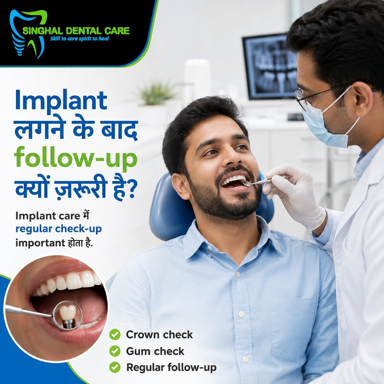 Dental Implant के बाद Regular Follow-Up क्यों जरूरी है?

Dental implant की long-term care के लिए regular follow-up महत्वपूर्ण होता है। Check-up के दौरान implant crown, gums, bite और आसपास की cleaning condition evaluate की जाती है, ताकि शुरुआती समस्या समय पर पहचानी और manage की जा सके।

Implant लगने के बाद सब ठीक लग रहा हो, तब भी regular follow-up जरूरी है।

Routine implant check-up में:

✅ Implant crown की fitting check होती है
✅ Gums की health evaluate होती है
✅ Bite pressure assess किया जाता है
✅ Cleaning और plaque control देखा जाता है
✅ शुरुआती looseness या discomfort समय पर detect हो सकता है

📍 Singhal Dental Care, C-26, Sector-C, Alkapuri Tiraha, Aliganj, Lucknow
📞 8299015161

dental implant follow up Lucknow, implant maintenance Aliganj, dental implant regular check-up, implant crown check, gum check after dental implant, dental implant care Lucknow, implant bite check, implant cleaning and maintenance, dental implant dentist Aliganj, long-term implant care, implant consultation Lucknow, Singhal Dental Care

#DentalImplant #ImplantFollowUp #ImplantCare #ImplantMaintenance #CrownCheck #GumHealth #DentalCheckup #ImplantDentist #LucknowDentist #AliganjLucknow #SinghalDentalCare