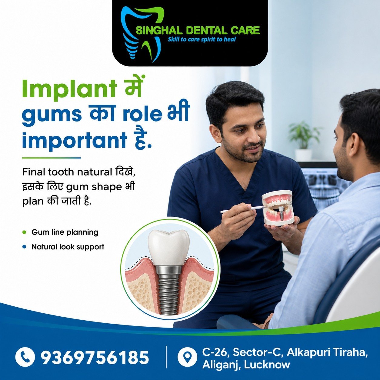 Implant में Gums का Role भी Important है

Dental implant का natural look केवल crown पर depend नहीं करता। Final tooth natural दिखे, इसके लिए gum line planning, gum shape और soft tissue support भी carefully assess किया जाता है। सही implant planning से smile appearance और final tooth look बेहतर हो सकता है.

📍 Singhal Dental Care, C-26, Sector-C, Alkapuri Tiraha, Aliganj, Lucknow
📞 8299015161

implant gum planning, gum role in dental implant, dental implant gum shape, gum line planning implant, natural looking dental implant, soft tissue support implant, implant crown natural look, implant aesthetic planning, gum contour for implant, implant healing gums, final tooth natural look, dental implant planning

#ImplantGums
#GumLinePlanning
#DentalImplant
#ImplantPlanning
#GumShape
#NaturalLookingImplant
#SoftTissueSupport
#ImplantCrown
#GumHealth
#ImplantHealing
#NaturalSmile
#DentalImplantCare
#SmileAesthetics