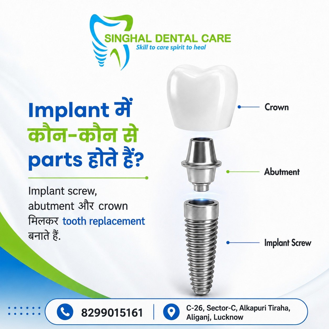 Dental Implant के 3 Main Parts कौन-कौन से होते हैं?

Dental implant तीन मुख्य parts से मिलकर बनता है—implant screw, abutment और crown। Implant screw jawbone में support देता है, abutment connector का काम करता है और crown natural tooth जैसा दिखाई देता है। सही planning और fitting से missing tooth replacement मजबूत और comfortable बन सकता है।

Dental implant एक ही piece नहीं होता। इसके तीन मुख्य parts होते हैं:

✅ Implant Screw — jawbone में support देता है
✅ Abutment — implant और crown को जोड़ता है
✅ Crown — ऊपर दिखाई देने वाला natural-looking tooth होता है

📍 Singhal Dental Care, C-26, Sector-C, Alkapuri Tiraha, Aliganj, Lucknow
📞 8299015161

dental implant parts, implant screw abutment crown, dental implant structure, parts of dental implant, missing tooth replacement Lucknow, implant crown treatment Aliganj, dental implant abutment, single tooth implant Lucknow, implant dentist Aliganj, natural tooth replacement, dental implant consultation Lucknow, Singhal Dental Care

#DentalImplant #ImplantParts #ImplantScrew #Abutment #DentalCrown #MissingTooth #ToothReplacement #ImplantDentist #LucknowDentist #AliganjLucknow #SinghalDentalCare