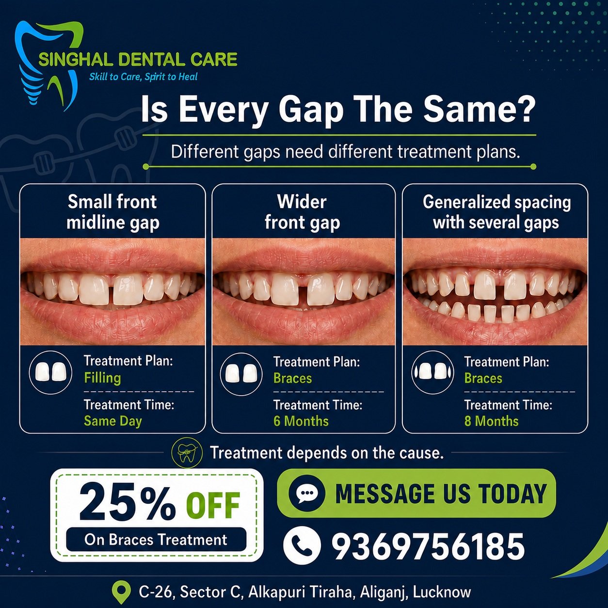हर Teeth Gap Same नहीं होता

दाँतों के gap का treatment gap size, cause और teeth alignment पर depend करता है। Small front gap में filling possible हो सकती है, जबकि wider gap या multiple gaps के लिए braces treatment की जरूरत पड़ सकती है। सही treatment plan के लिए consultation book करें।

📍 Singhal Dental Care, C-26, Sector-C, Alkapuri Tiraha, Aliganj, Lucknow
📞 9369756185

teeth gap treatment, front teeth gap, small teeth gap filling, wider front gap braces, multiple teeth gaps, braces treatment Lucknow, teeth spacing treatment, diastema treatment, orthodontic treatment Aliganj, gap closing treatment, dental clinic Aliganj, Singhal Dental Care, braces offer Lucknow, dentist in Lucknow

#TeethGap
#DentalGap
#FrontTeethGap
#SmallGapTreatment
#BracesTreatment
#GapClosing
#DiastemaTreatment
#TeethSpacing
#OrthodonticTreatment
#SmileCorrection
#ConfidentSmile
#BracesOffer
#LucknowDentist
#AliganjDentist
#SinghalDentalCare
#LucknowPeople
#LucknowCity
#LucknowLife
#Kapoorthala
#GomtiNagarLucknow
#DentalClinicLucknow
#AliganjLucknow