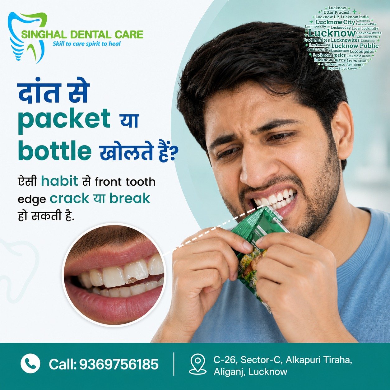 दांत से Packet खोलते हैं? Front Tooth टूट सकता है

दांत का इस्तेमाल packet, bottle या hard चीजें खोलने के लिए करना front tooth edge को damage कर सकता है। इससे tooth crack, chip, sensitivity या breakage हो सकती है। ऐसी habit avoid करें और chipped या cracked tooth दिखे तो dental check-up जरूर कराएँ.

packet opening with teeth, bottle opening with teeth, front tooth crack, chipped front tooth, broken front tooth, tooth edge crack, tooth damage habit, teeth misuse, front tooth injury, tooth chip treatment, cracked tooth treatment, dental habit awareness, cosmetic tooth repair, tooth fracture, dental checkup

#ToothCrack, #ChippedTooth, #BrokenTooth, #FrontToothDamage, #ToothInjury, #DentalHabits, #TeethCare, #ToothFracture, #ToothChipTreatment, #CrackedTooth, #CosmeticToothRepair, #DentalAwareness, #OralHealth, #DentalCare