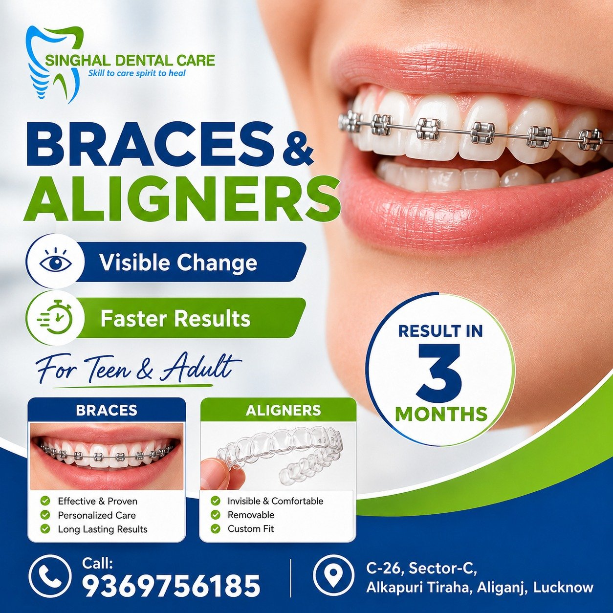 Braces or Aligners? Get Your Smile Aligned

Crooked teeth, gaps या misalignment की वजह से smile confidence affect हो सकता है। Braces और aligners teeth alignment improve करने में help कर सकते हैं। कौन सा option आपके लिए better है, यह teeth condition, age, lifestyle और treatment need के अनुसार decide किया जाता है.

braces and aligners, braces treatment, aligners treatment, teeth alignment, crooked teeth correction, misaligned teeth, teeth straightening, smile correction, visible smile change, clear aligners, metal braces, invisible aligners, removable aligners, braces for teens, braces for adults, orthodontic treatment, gap correction, crowding treatment, smile confidence, dental alignment treatment

#Braces, #Aligners, #BracesAndAligners, #TeethAlignment, #CrookedTeeth, #MisalignedTeeth, #TeethStraightening, #SmileCorrection, #ClearAligners, #InvisibleAligners, #MetalBraces, #BracesForTeens, #BracesForAdults, #OrthodonticTreatment, #ConfidentSmile