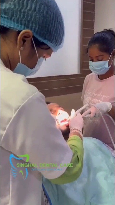 Yellow Stains या Tartar? Professional Teeth Cleaning कराएँ

दांतों पर जमा tartar, plaque, tobacco stains या tea-coffee stains normal brushing से पूरी तरह साफ नहीं होते। Professional teeth cleaning / scaling से deposits remove करने, gums को healthy रखने और smile को cleaner look देने में मदद मिल सकती है.

teeth cleaning, dental cleaning, dental scaling, tartar removal, plaque removal, yellow teeth cleaning, tobacco stain removal, tea coffee stains, teeth polishing, gum cleaning, bad breath problem, oral hygiene, stained teeth cleaning, professional dental cleaning, clean smile

#TeethCleaning, #DentalCleaning, #DentalScaling, #TartarRemoval, #PlaqueRemoval, #YellowTeeth, #TobaccoStains, #TeaCoffeeStains, #TeethPolishing, #GumCleaning, #BadBreath, #OralHygiene, #CleanSmile, #DentalCare, #HealthyTeeth